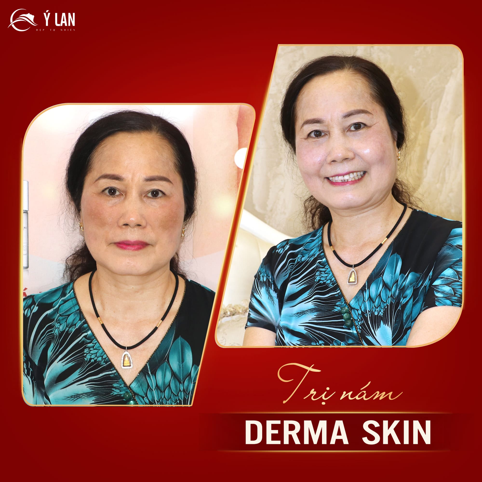 nam_dermaskin-min