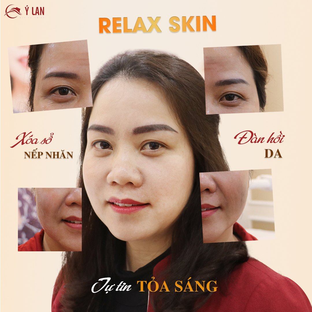 li-xi-dau-xuan-tham-my-y-lan1