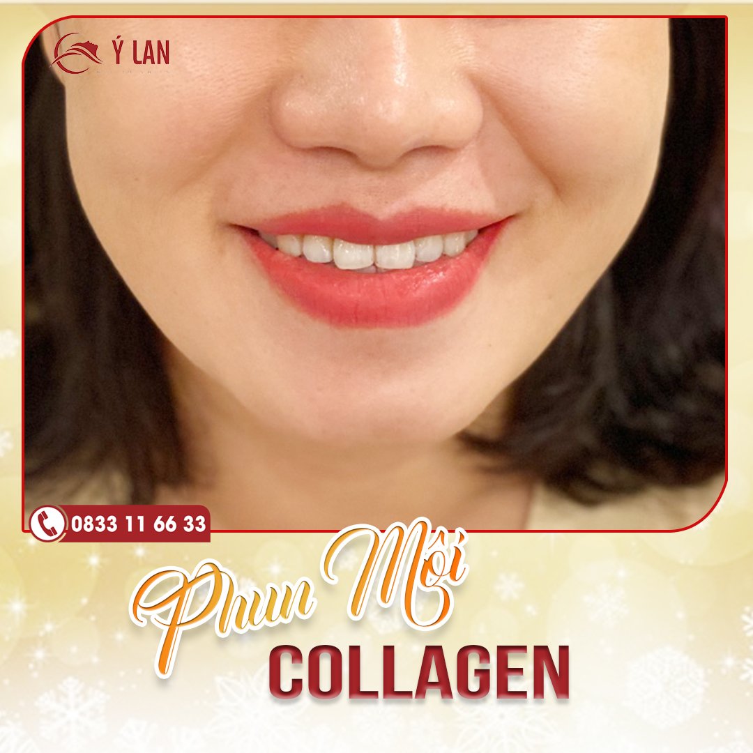 li-xi-dau-xuan-tham-my-y-lan3 (1)