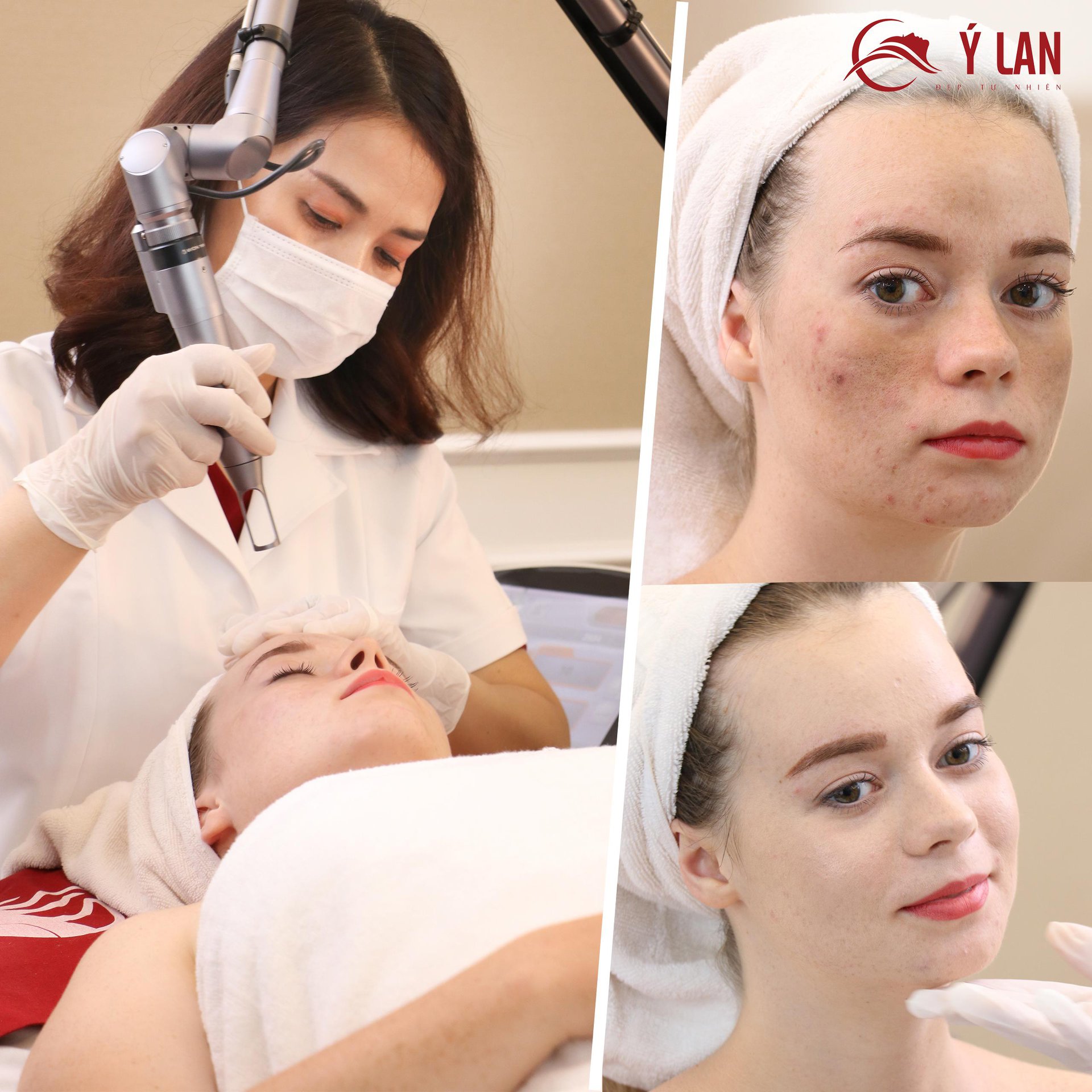 li-xi-dau-xuan-tham-my-y-lan6