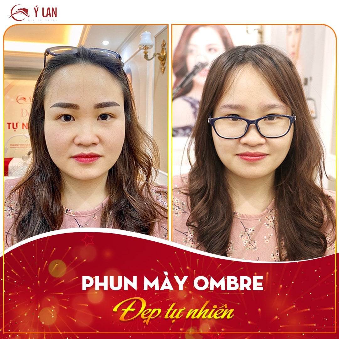 li-xi-dau-xuan-tham-my-y-lan8