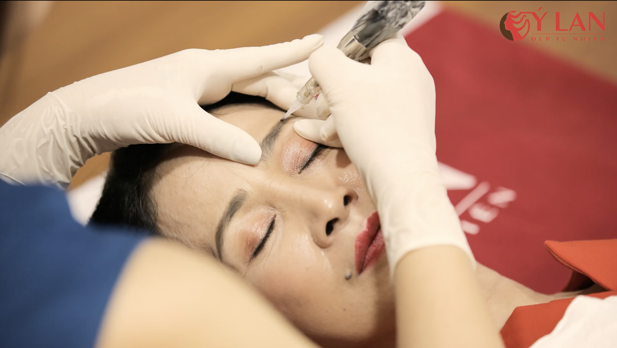 tham-my-vien-y-lan-noi-chon-mat-gui-vang-cua-hang-nghin-khach-hang-2