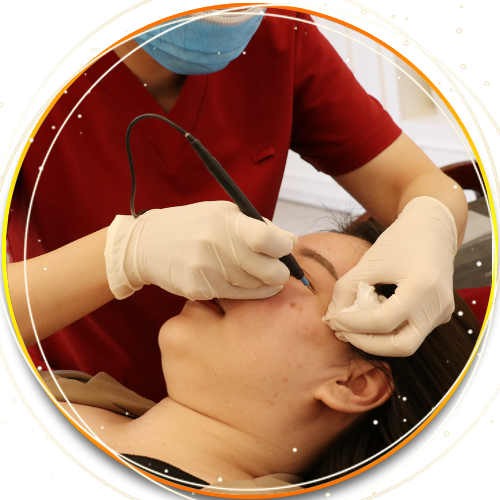 Xoá-mụn-thịt-CN-Fractional