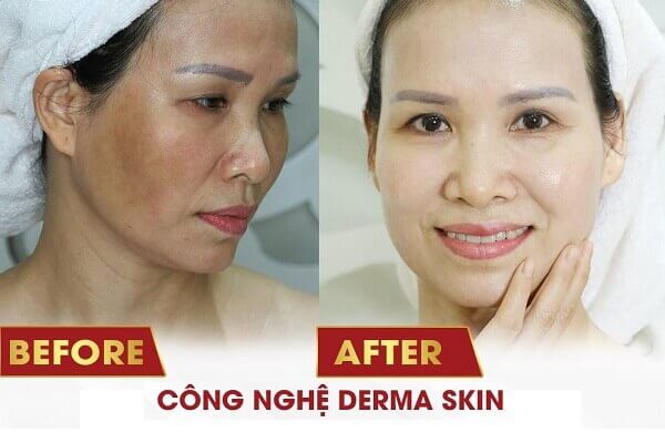 tri nam derma skin (1) (1)