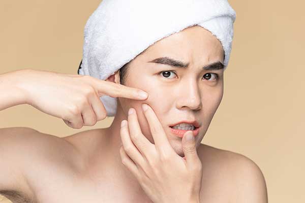 Chăm sóc da sau nặn mụn như thế nào?