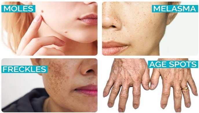 phan biet nam tan nhang