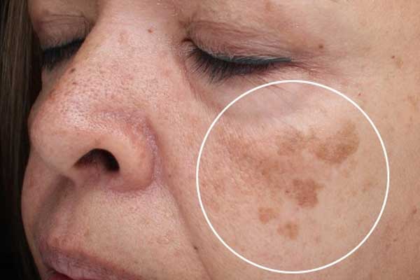 phan-biet-nam-tan-nhang-doi-moi-3