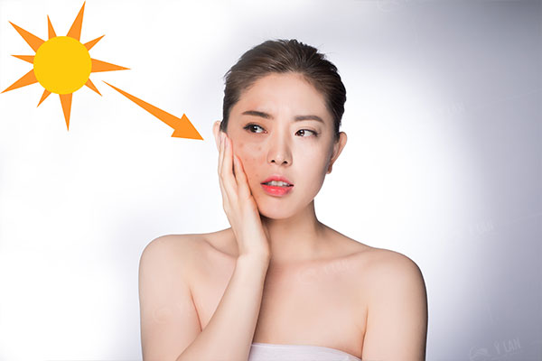 nguyen-nhan-gay-nam-da