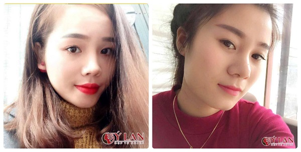 phun-theu-long-may-1