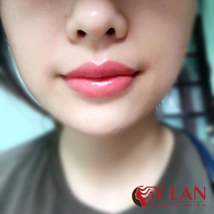 36942842_1551063588355329_6297961161761488896_n