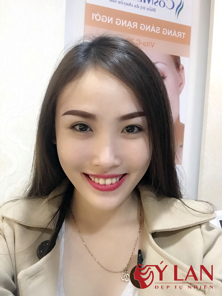 khuon-mat-tuoi-tre-rang-ngoi-khi-doi-dang-long-may