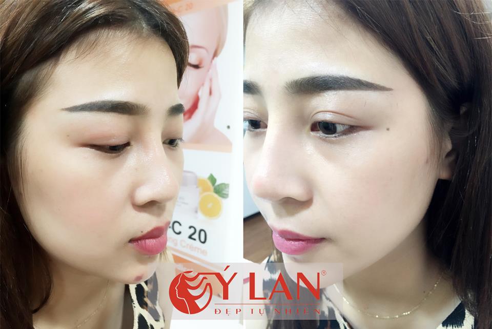 phun-theu-chan-may-tu-nhien-xu-huong-lam-dep-moi-4