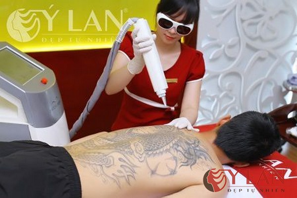 xoa-xam-may-an-toan-bang-laser-2